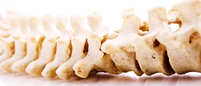 spinal stenosis