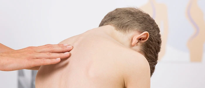 Chiropractic Care For Scoliosis Relief
