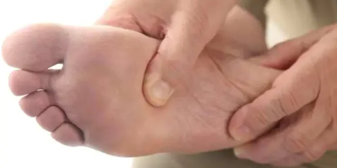 Plantar Fasciitis Specialist Raleigh NC